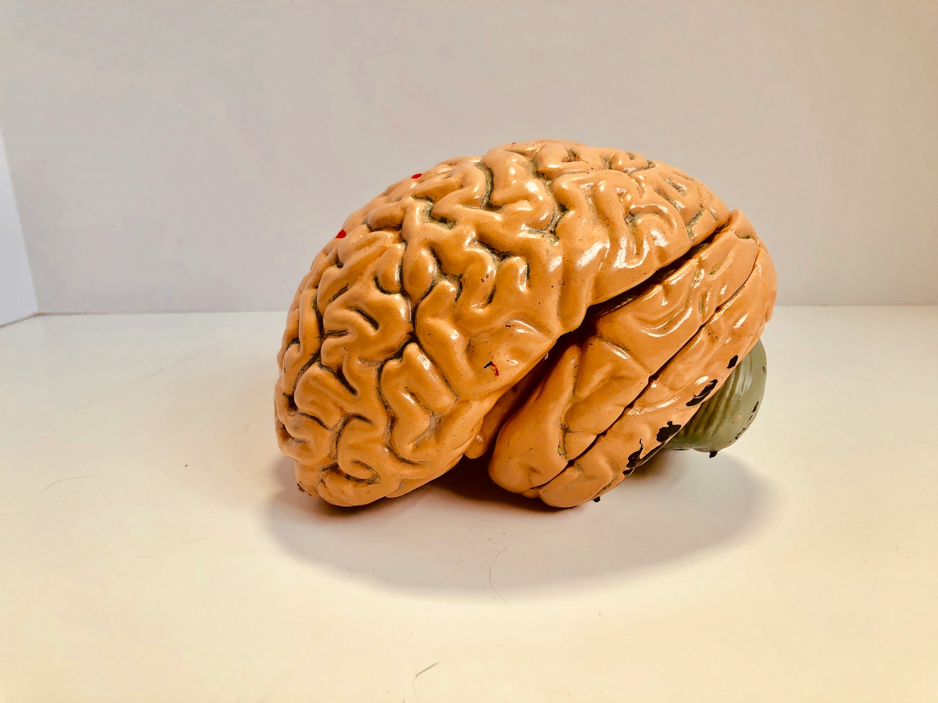 A model of a human brain, representing traumatic brain injury.